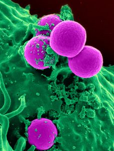 round purple stem cells surrounded by green liquid.