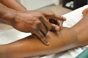 African American arm getting acupuncture needles put in forearm.