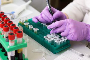 hands in purple gloves writing on test tubes place don a green tray.