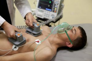 Caucasian young man laying down with wires hooke dup to chest about to be shocked by the doctor. Cardioversion. 