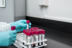 lab tech with tubes of blood