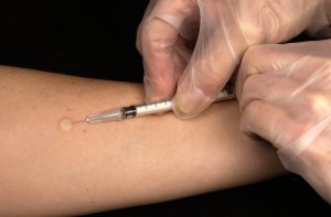 caucasian hand with a clear glove on holding a needle inserting it into a caucasian arm.