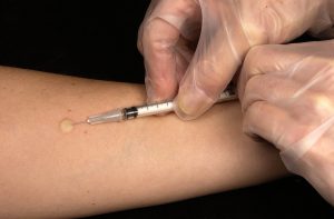 persons arm getting a shot of clear liquid into their arm from a hand with a clear glove on it