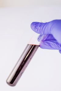 purple glove holding a tube full of blood