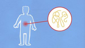 illustration of someone with red on their stomach area and a microscope of the inside of the stomach on the side 