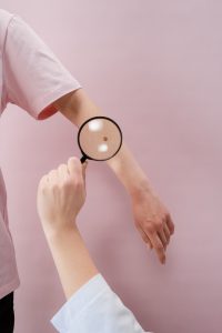 magnifying glass looking at a mole on someone's arm