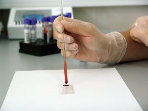 blood sample being put on a test