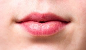 picture of dry lips