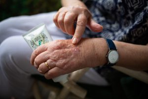 older womans hand with a finger pointing at her hand