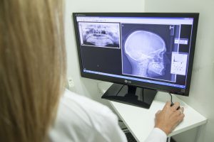 x-ray of a person's head
