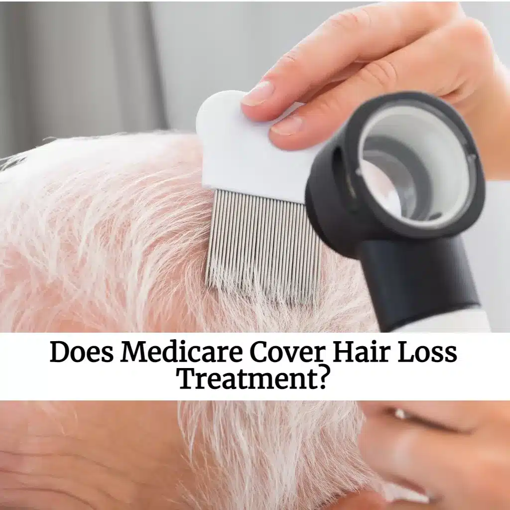 Does Medicare Cover Hair Loss Treatment? EZ.Insure