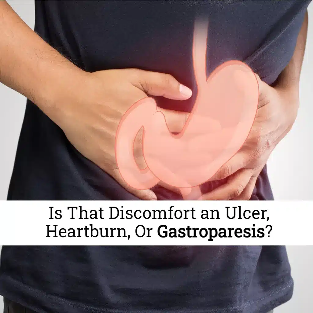 Is That an Ulcer, Heartburn, Or Gastroparesis? EZ.Insure