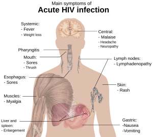 illustration of the human body and HIV symptoms that affects each part of it