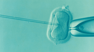 IVF treatment with egg and sperm
