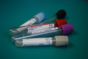 empty blood test tubes