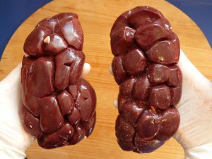 red kidneys