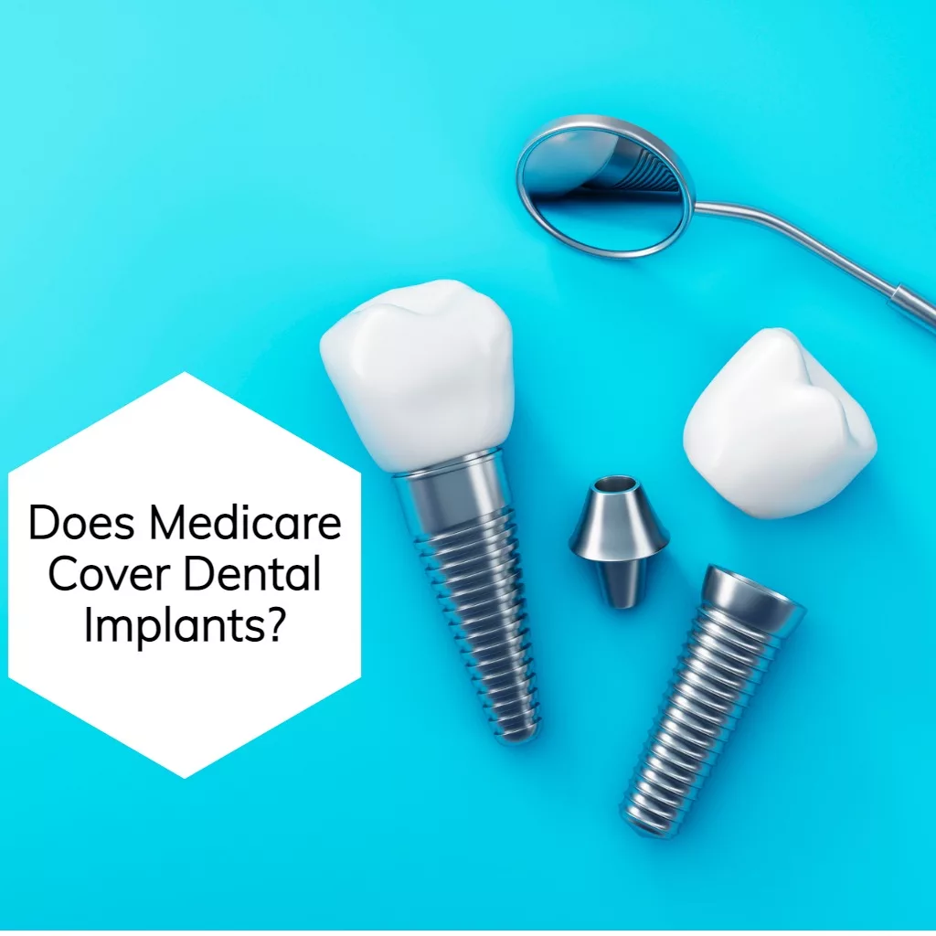 Does Medicare Cover Dental Implants? EZ.Insure