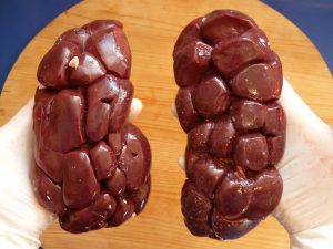 kidneys