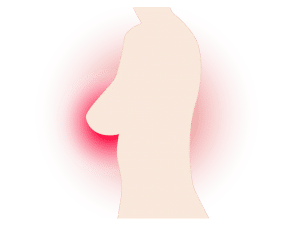 illustration of a woman's body with red around the breast